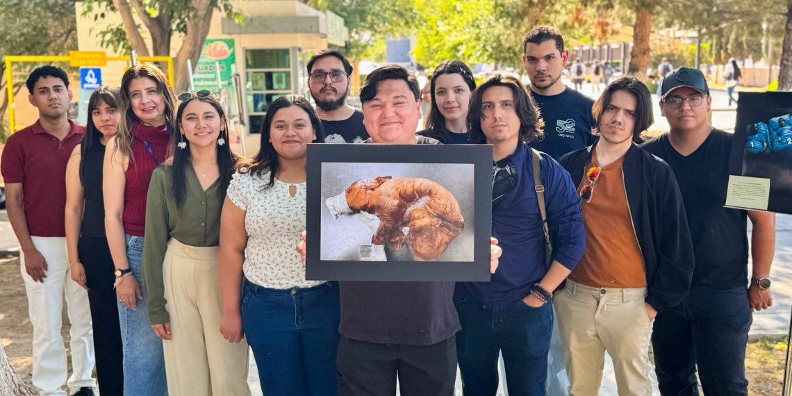 ENTRE DILEMAS Y MIRADAS; ESTUDIANTES DE BIOMEDICA CONVIERTEN LA FOTOGRAFIA EN UN DEBATE SOBRE LA VIDA